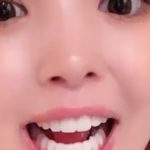 藤田ニコルは大満足のようだが…若い女性に人気のセラミック矯正の落とし穴とは？