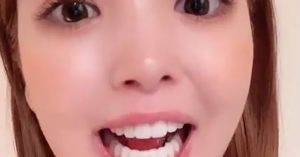 藤田ニコルは大満足のようだが…若い女性に人気のセラミック矯正の落とし穴とは？