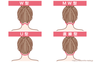 うなじ脱毛を考える前に知っておきたい医療脱毛とサロン脱毛の違いとは？