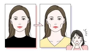 頬がこける？ハイフの効果と副作用について解説
