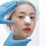 美容整形トラブル増加中！40代主婦が地獄の施術を告白