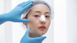 美容整形トラブル増加中！40代主婦が地獄の施術を告白