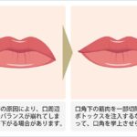 元トップ艶系女優が語る「注入系」整形の注意点とは？