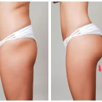 美尻を手に入れる！股関節を動かしてお尻を引き締めるトレーニング方法