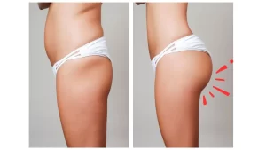 美尻を手に入れる！股関節を動かしてお尻を引き締めるトレーニング方法