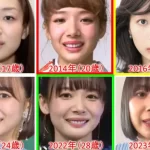 モデル雀士岡田紗佳のおでこがボコボコ!? 美容整形の結果にファン騒然