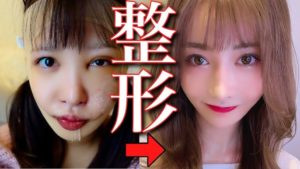 整形アイドルが語る、整形手術のリスクと後遺症の怖さ