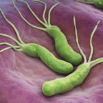 ピロリ菌感染による胃がん予防の重要性とは？