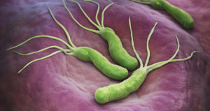 ピロリ菌感染による胃がん予防の重要性とは？