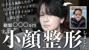 250万円かけて小顔整形を施したYouTuber、ビフォーアフター公開で話題に！