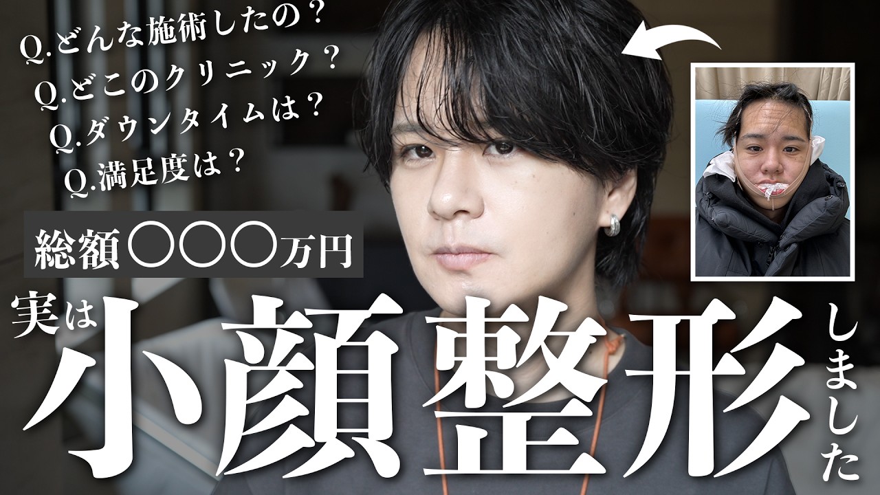 250万円かけて小顔整形を施したYouTuber、ビフォーアフター公開で話題に！