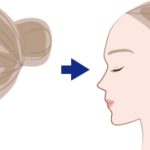 SSRO整形で両顎を動かした結果、3日間の苦痛―気管切開のリスクを考える