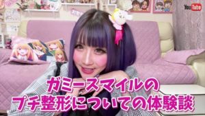 登録者70万人超えYouTuber・ちいめろが口元整形のビフォアフ写真を公開