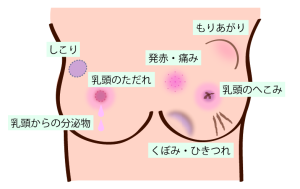 乳がんになると乳房に現れるくぼみ、その意味とは？