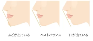 美容整形人気芸人の美人妻、喜びの涙！「ぽかぽか」生放送中にビフォーアフターを披露