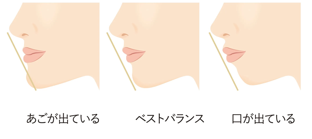 美容整形人気芸人の美人妻、喜びの涙！「ぽかぽか」生放送中にビフォーアフターを披露