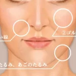 37歳整形アイドルがほうれい線施術を告白！驚きのエピソードとは？