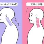 スマホ首やストレートネックを改善するストレッチ方法とは？
