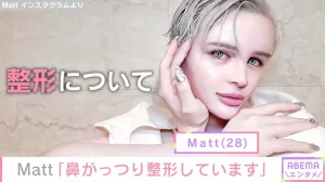 Mattが1000万円整形費用を公表！“こすりすぎ”告白にネットの反応は？