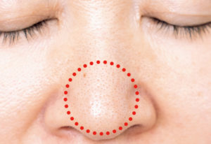 毛穴悩みを解消！理想のちゅるるん肌に導く油分が重要な理由とは？