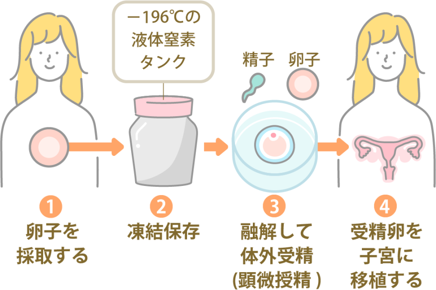 35歳までに卵子凍結を考える理由とは？最新の情報を知ろう！