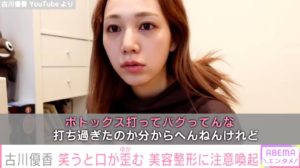 古川優香、ボトックス注射で「顔バグった」視聴者に注意喚起も